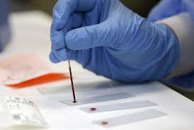 DUI blood test
